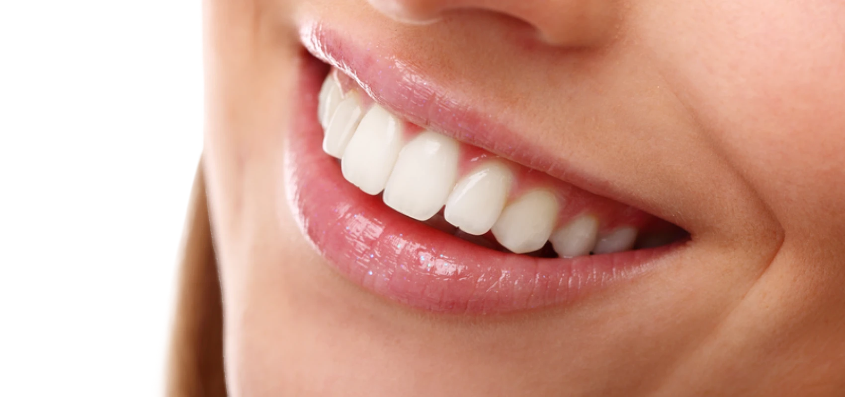 Traitement esthétique dentaire